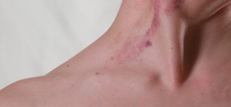 Family Violence Intervention Order (FVIO) Guide Victoria | How to Apply for FVIO